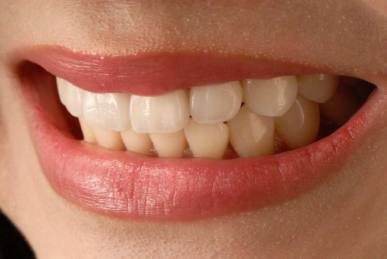 Brücken, Kronen, Veneers – Es gibt vielfältige Möglichkeiten im Rahmen der Zahnästhetik